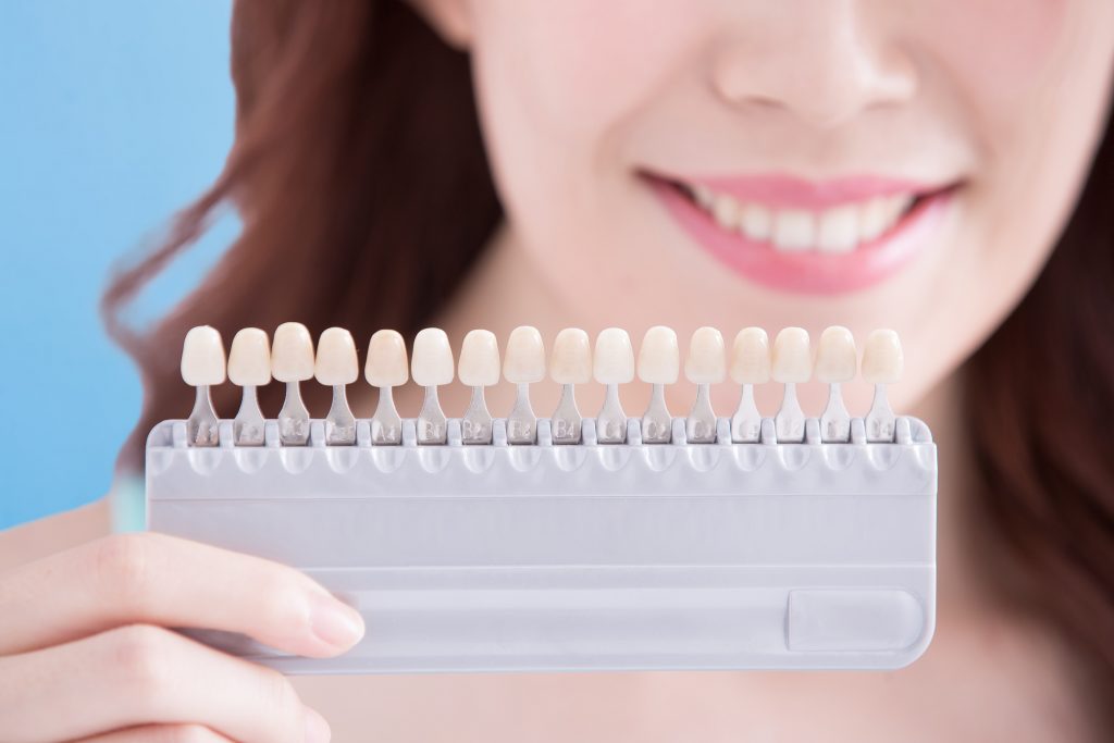 Picking the Perfectly Coloured Dental Crown