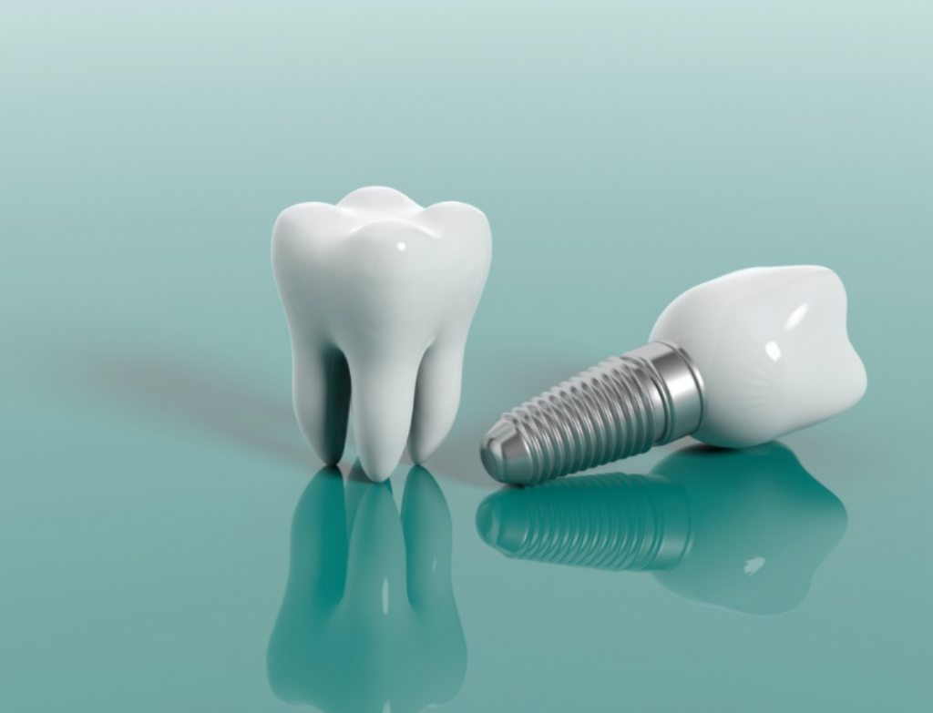 what makes someone a good candidate for dental implants