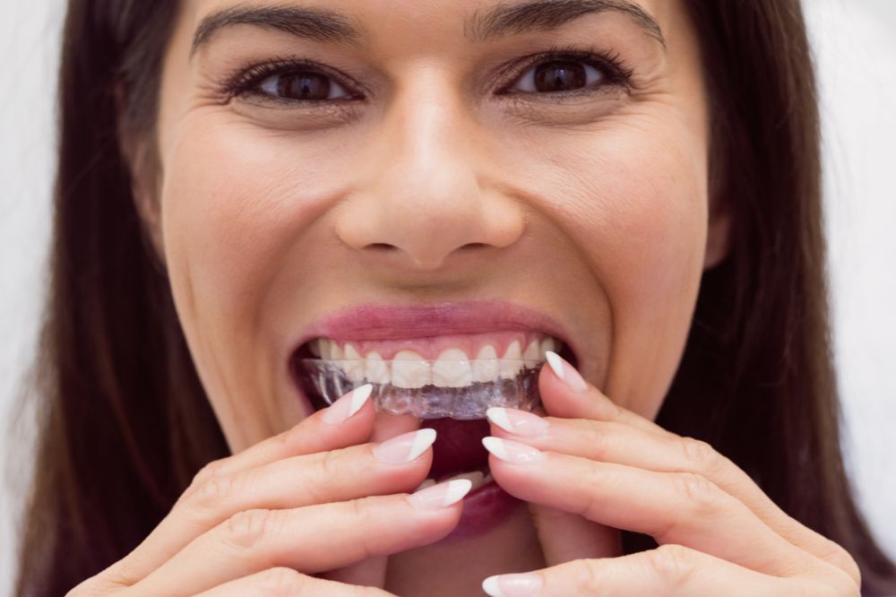 is invisalign painful what to expect during treatment